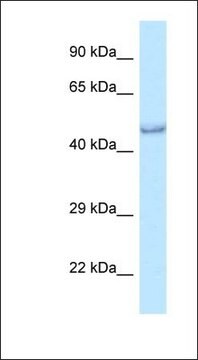 Anti-PRMT6 antibody produced in rabbit affinity isolated antibody