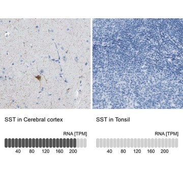 Anti-SST antibody produced in rabbit affinity isolated antibody, buffered aqueous glycerol solution