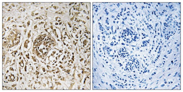 Anti-CIB2 antibody produced in rabbit affinity isolated antibody