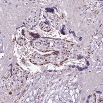 Anti-SRSF4 antibody produced in rabbit Prestige Antibodies&#174; Powered by Atlas Antibodies, affinity isolated antibody, buffered aqueous glycerol solution