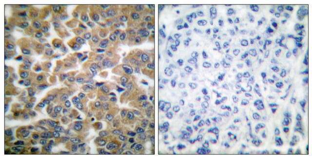 Anti-GR antibody produced in rabbit affinity isolated antibody