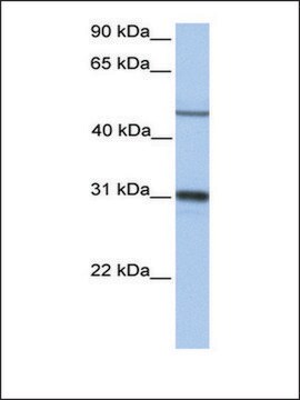 Anti-EPHX1 antibody produced in rabbit affinity isolated antibody