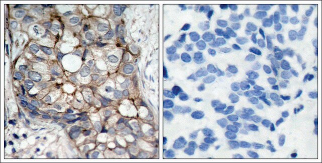 Anti-EGFR (Ab-1070) antibody produced in rabbit affinity isolated antibody