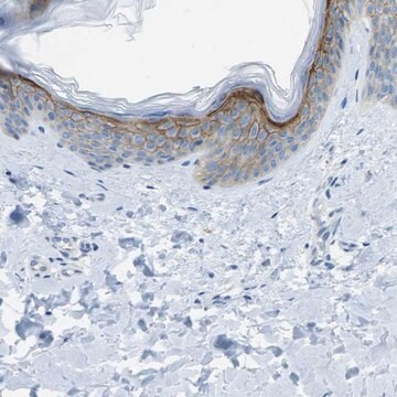 Anti-SDC1 antibody produced in rabbit Prestige Antibodies&#174; Powered by Atlas Antibodies, affinity isolated antibody, buffered aqueous glycerol solution