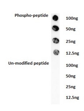 Anti-phospho-ACK1 (Tyr284) Antibody Upstate&#174;, from rabbit