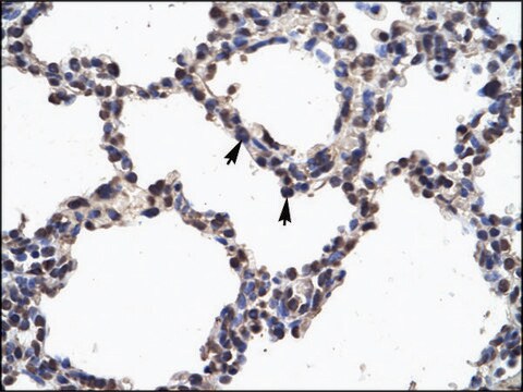 Anti-NFKB2 (AB2) antibody produced in rabbit affinity isolated antibody