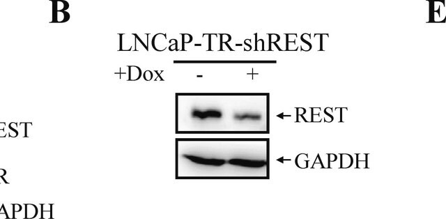 Anti-REST Antibody from rabbit, purified by affinity chromatography