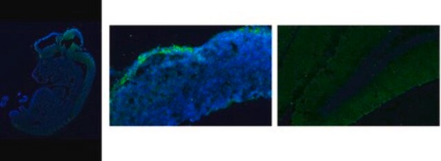 Anti-Neurocan Antibody, N-terminal from rabbit