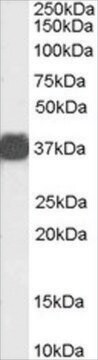 Anti-Arginase, Type 1/ARG1 (AB2) antibody produced in goat affinity isolated antibody, buffered aqueous solution