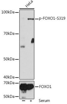 Anti-Phospho-FOXO1-S319 antibody produced in rabbit