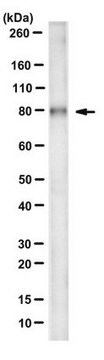 Anti-Plakophilin 1 Antibody, clone 10B2 clone 10B2, from mouse