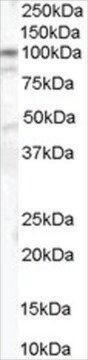 Anti-Catenin &#945;1 antibody produced in goat affinity isolated antibody, buffered aqueous solution