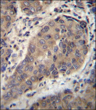 ANTI-WTIP (C-TERM) antibody produced in rabbit IgG fraction of antiserum, buffered aqueous solution