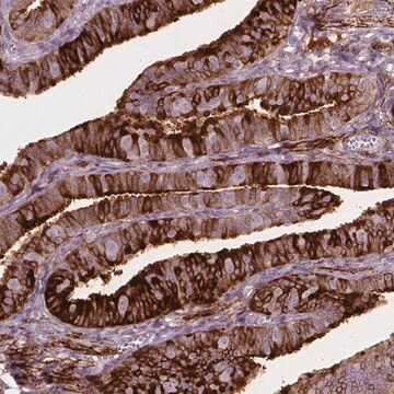 Anti-TM6SF2 antibody produced in rabbit Prestige Antibodies&#174; Powered by Atlas Antibodies, affinity isolated antibody, buffered aqueous glycerol solution