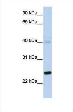 Anti-HSPB8 antibody produced in rabbit affinity isolated antibody