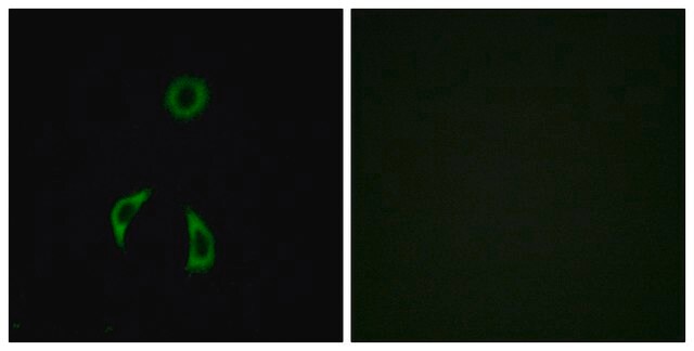 Anti-FZD3 antibody produced in rabbit affinity isolated antibody