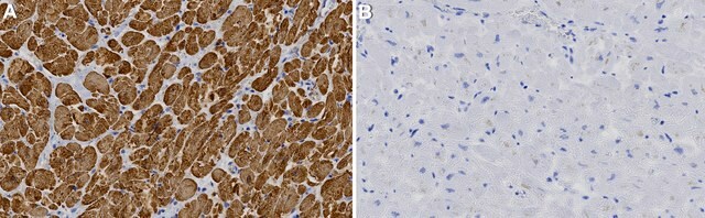 Anti-MLC-2 Antibody, clone 1B16 ZooMAb&#174; Rabbit Monoclonal recombinant, expressed in HEK 293 cells