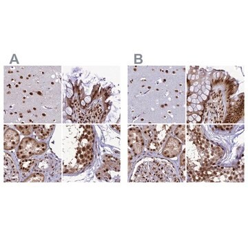 Anti-DDX1 antibody produced in rabbit Prestige Antibodies&#174; Powered by Atlas Antibodies, affinity isolated antibody, buffered aqueous glycerol solution