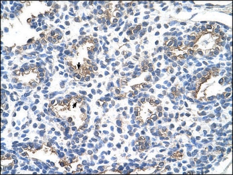 Anti-CEACAM6 IgG fraction of antiserum