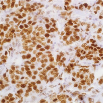 EZH2 (11) Mouse Monoclonal Antibody