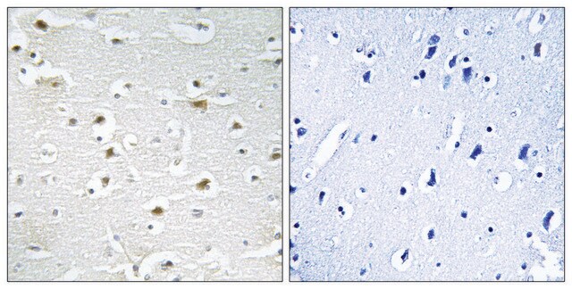 Anti-DDX3Y antibody produced in rabbit affinity isolated antibody