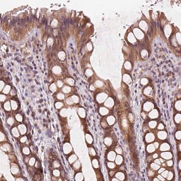 Anti-KIAA0895L antibody produced in rabbit Prestige Antibodies&#174; Powered by Atlas Antibodies, affinity isolated antibody, buffered aqueous glycerol solution