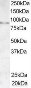 Anti-AKAP3/SOB1 antibody produced in goat affinity isolated antibody, buffered aqueous solution