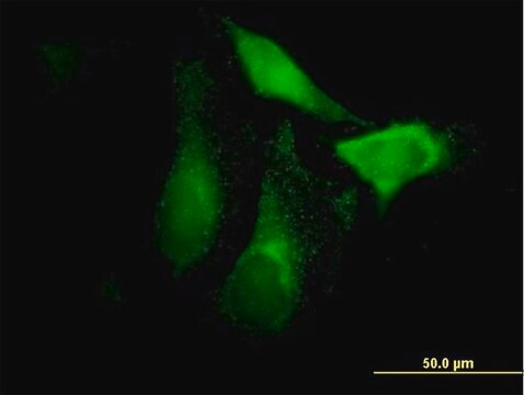 Anti-CFHR1 antibody produced in mouse IgG fraction of antiserum, buffered aqueous solution