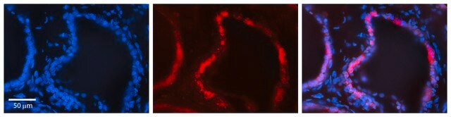 Anti-ADIPOR1 (C-terminal) antibody produced in rabbit affinity isolated antibody