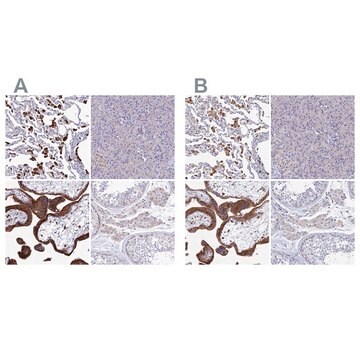 Anti-SPNS1 antibody produced in rabbit Prestige Antibodies&#174; Powered by Atlas Antibodies, affinity isolated antibody, buffered aqueous glycerol solution