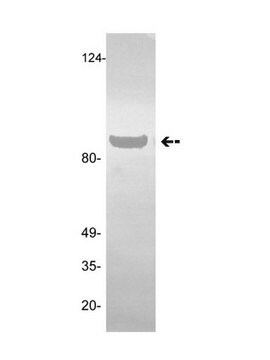 Anti-Plasminogen/Angiostatin Antibody, clone GMA-013 clone GMA-013, Upstate&#174;, from mouse