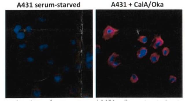 Anti-Phosphothreonine Antibody, clone RM102 clone RM102, from rabbit, purified by affinity chromatography