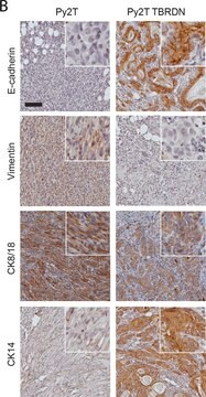 Monoclonal Anti-Vimentin antibody produced in mouse clone LN-6, ascites fluid