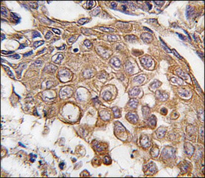 Anti-ALOX5AP (center) antibody produced in rabbit saturated ammonium sulfate (SAS) precipitated, buffered aqueous solution