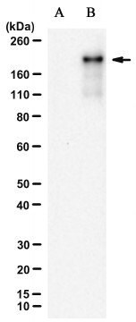 Anti-SARS-CoV-2 Spike N501Y Antibody, clone 6D4-E2