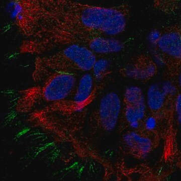 Anti-STOML3 antibody produced in rabbit Prestige Antibodies&#174; Powered by Atlas Antibodies, affinity isolated antibody, buffered aqueous glycerol solution