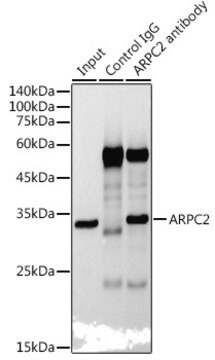 Anti-ARPC2 Antibody, clone 4F2G6, Rabbit Monoclonal