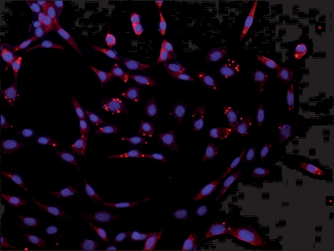 Anti-DCP2 (C-terminal) antibody produced in rabbit ~1&#160;mg/mL, affinity isolated antibody, buffered aqueous solution