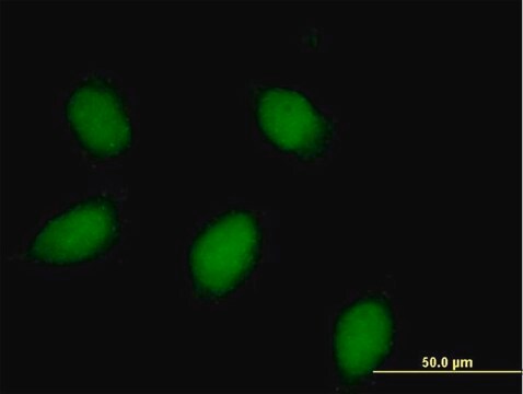 Anti-CALB1 antibody produced in rabbit purified immunoglobulin, buffered aqueous solution