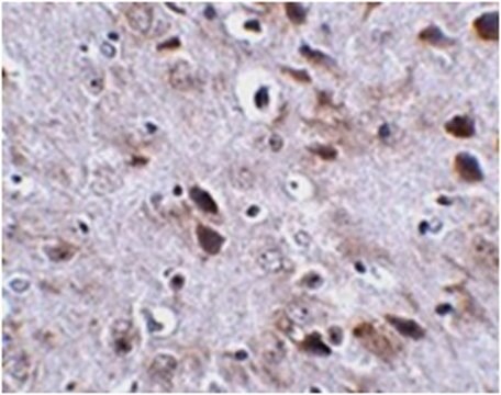 Anti-TMEM18 Antibody from rabbit, purified by affinity chromatography