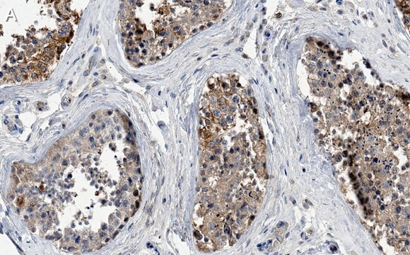 Anti-PKM2 Antibody, clone 1B2 ZooMAb&#174; Rabbit Monoclonal recombinant, expressed in HEK 293 cells