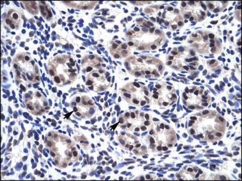 Anti-SP7 antibody produced in rabbit affinity isolated antibody