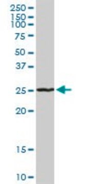 Anti-RAB7L1 antibody produced in rabbit purified immunoglobulin, buffered aqueous solution