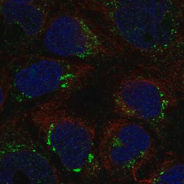 Anti-ATP7B antibody produced in rabbit Prestige Antibodies&#174; Powered by Atlas Antibodies, affinity isolated antibody