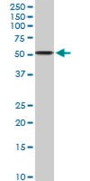 Anti-ALDH3A2 antibody produced in rabbit purified immunoglobulin, buffered aqueous solution