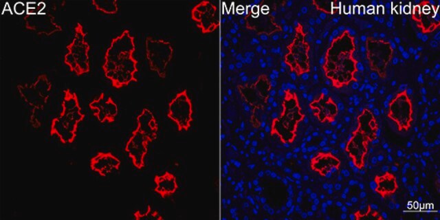 Anti-ACE2 Antibody, clone 5X5W10, Rabbit Monoclonal