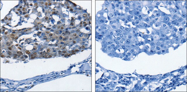 Anti-BPIFB1 antibody produced in rabbit affinity isolated antibody