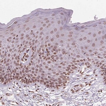 Anti-TMEM175 antibody produced in rabbit Prestige Antibodies&#174; Powered by Atlas Antibodies, affinity isolated antibody, buffered aqueous glycerol solution