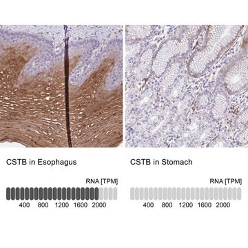 Anti-CSTB antibody produced in rabbit Prestige Antibodies&#174; Powered by Atlas Antibodies, affinity isolated antibody, buffered aqueous glycerol solution