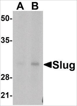 Anti-Slug (ab1) antibody produced in rabbit affinity isolated antibody, buffered aqueous solution